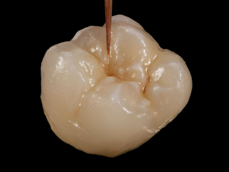 InSync FC easy to apply