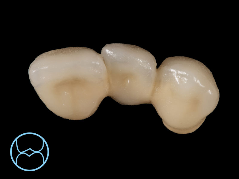 Härte von natürlichen Zähnen