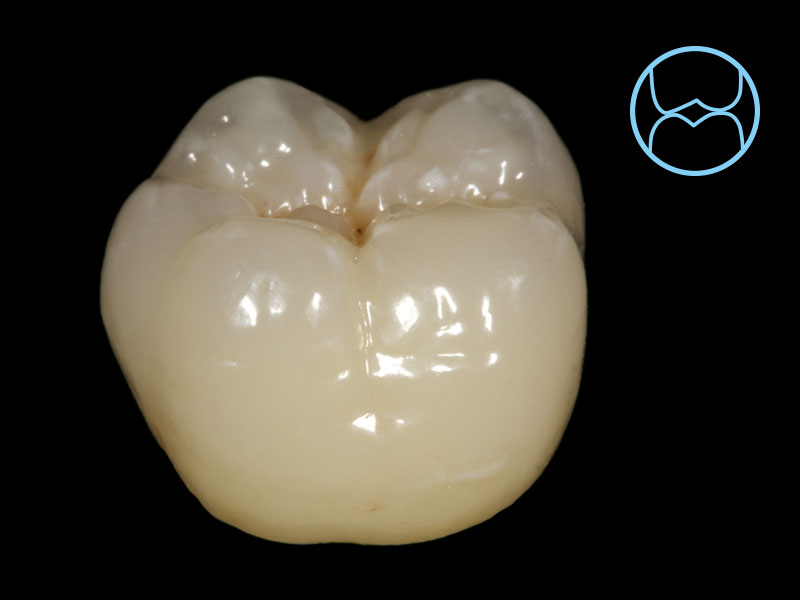 Hardness of natural teeth