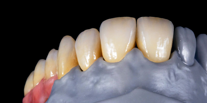 Hybrid-Technik InSync und MiYO